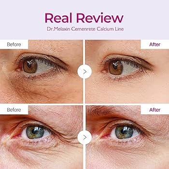 Dr. Melaxin Cemenrete Calcium Volume Eye Patch - Ενισχυτικά patches με ασβέστιο & κολλαγόνο - Image 2
